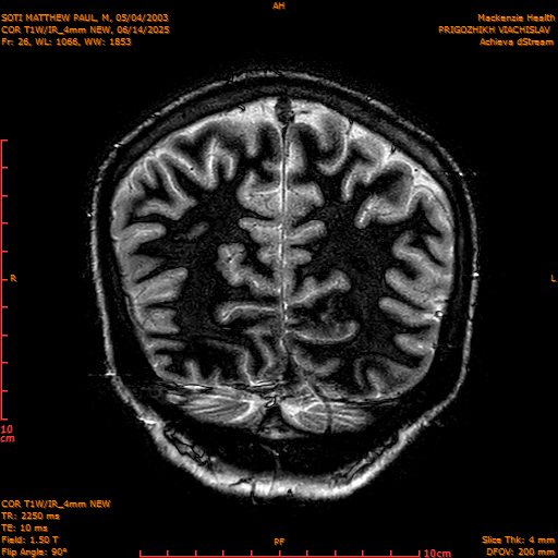 2025-06-14/COR T1W-IR_4mm NEW/0027-IM1018.png