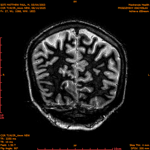 2025-06-14/COR T1W-IR_4mm NEW/0028-IM1019.png