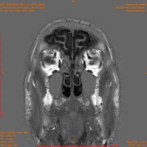 2025-06-14/COR T1W-IR_4mm NEW/0029-IM1020.png