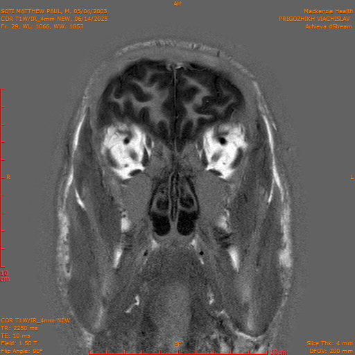 2025-06-14/COR T1W-IR_4mm NEW/0030-IM1021.png