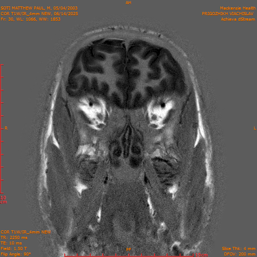 2025-06-14/COR T1W-IR_4mm NEW/0031-IM1022.png