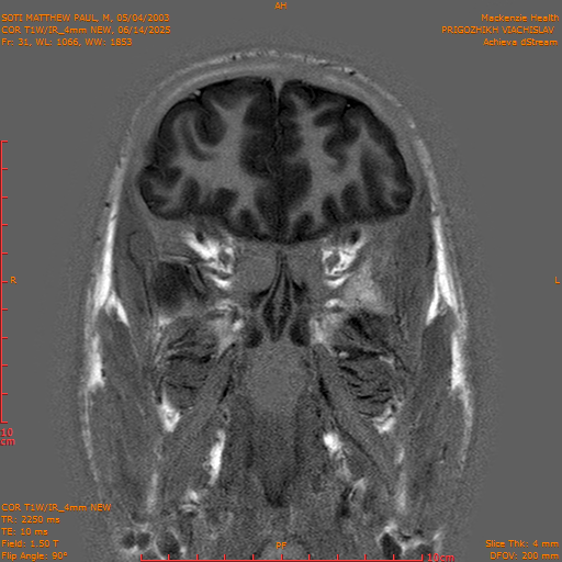 2025-06-14/COR T1W-IR_4mm NEW/0032-IM1023.png
