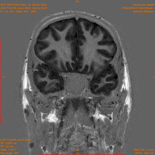 2025-06-14/COR T1W-IR_4mm NEW/0035-IM1026.png