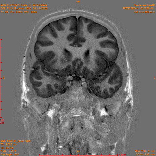 2025-06-14/COR T1W-IR_4mm NEW/0037-IM1028.png