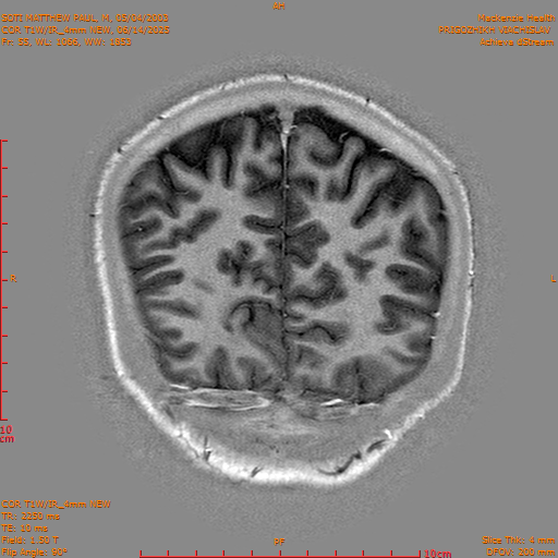 2025-06-14/COR T1W-IR_4mm NEW/0056-IM1047.png