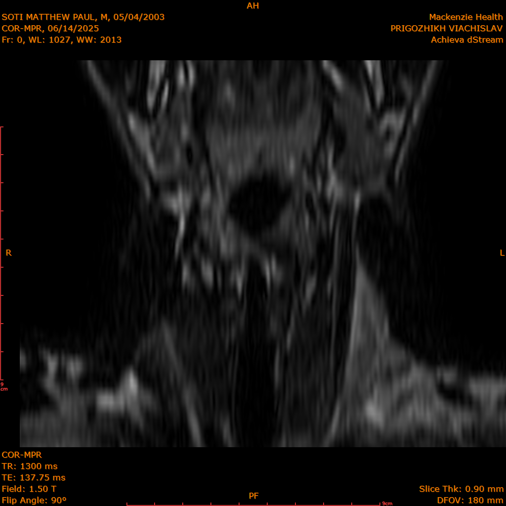 2025-06-14/COR-MPR/0001-.png