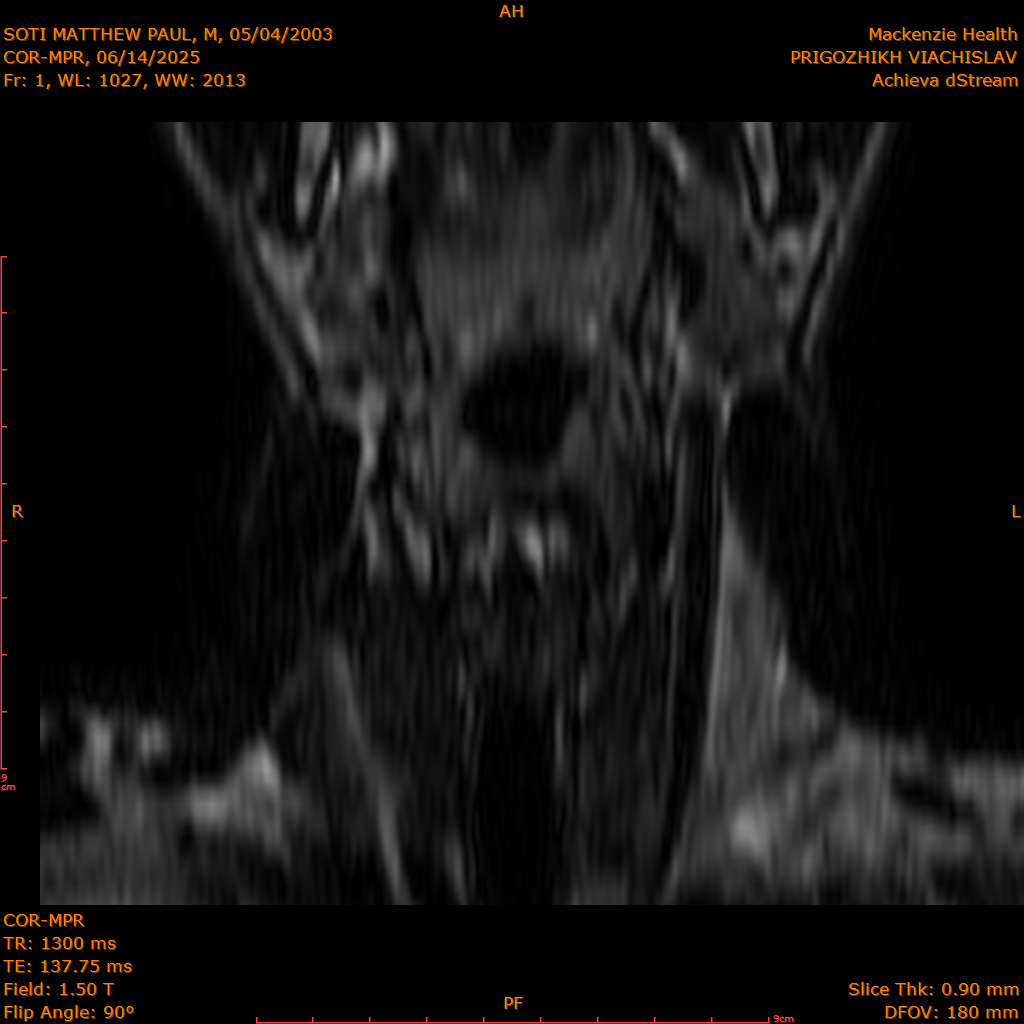 2025-06-14/COR-MPR/0002-.png