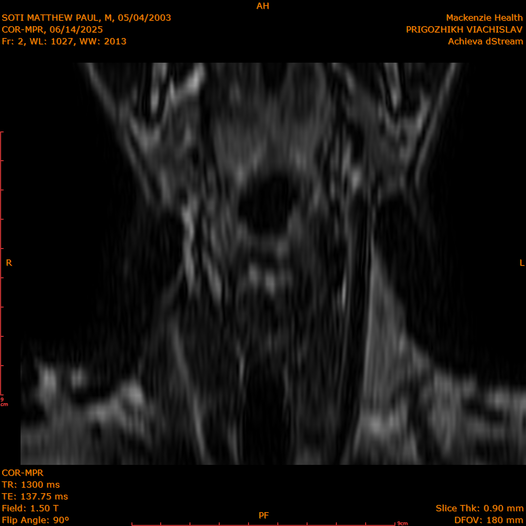2025-06-14/COR-MPR/0003-.png