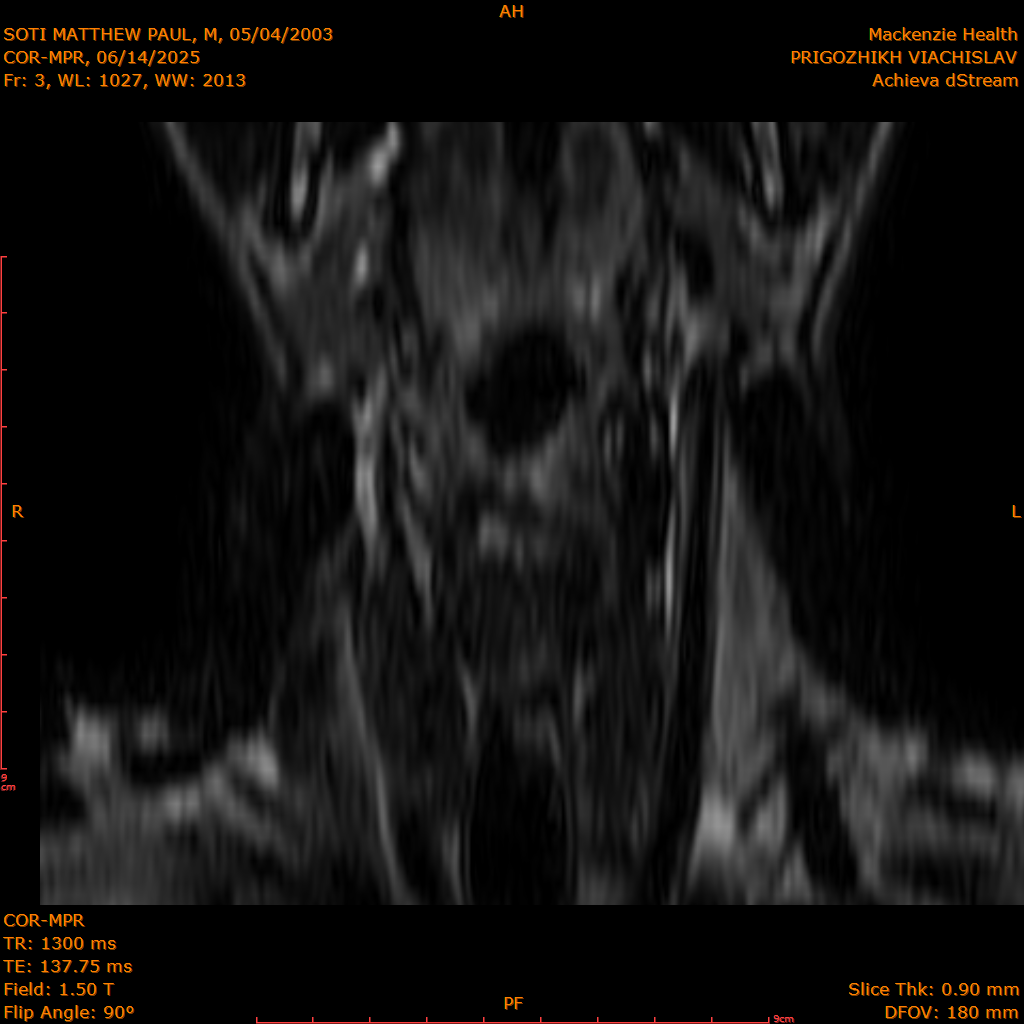 2025-06-14/COR-MPR/0004-.png