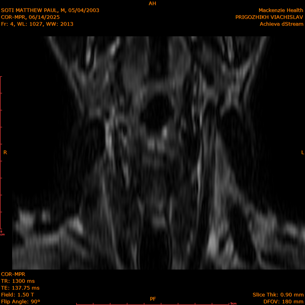 2025-06-14/COR-MPR/0005-.png