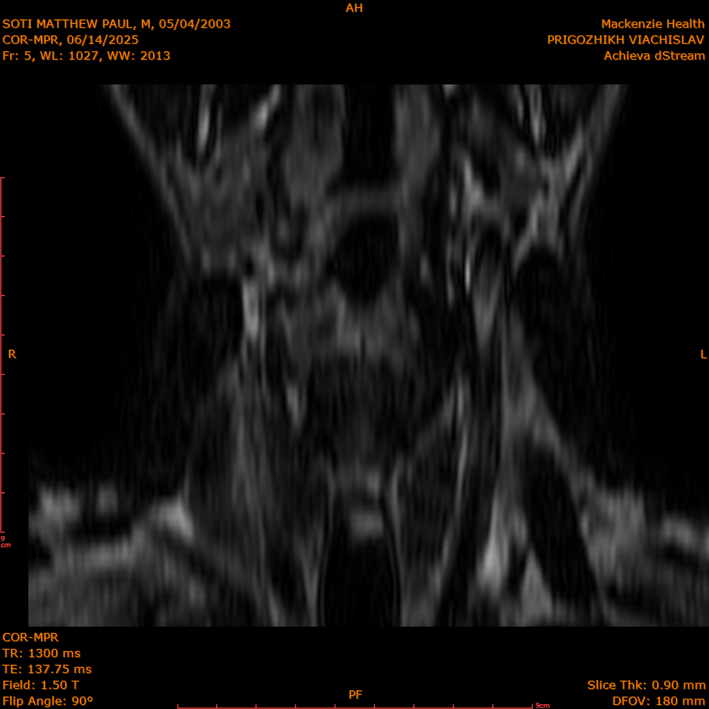 2025-06-14/COR-MPR/0006-.png