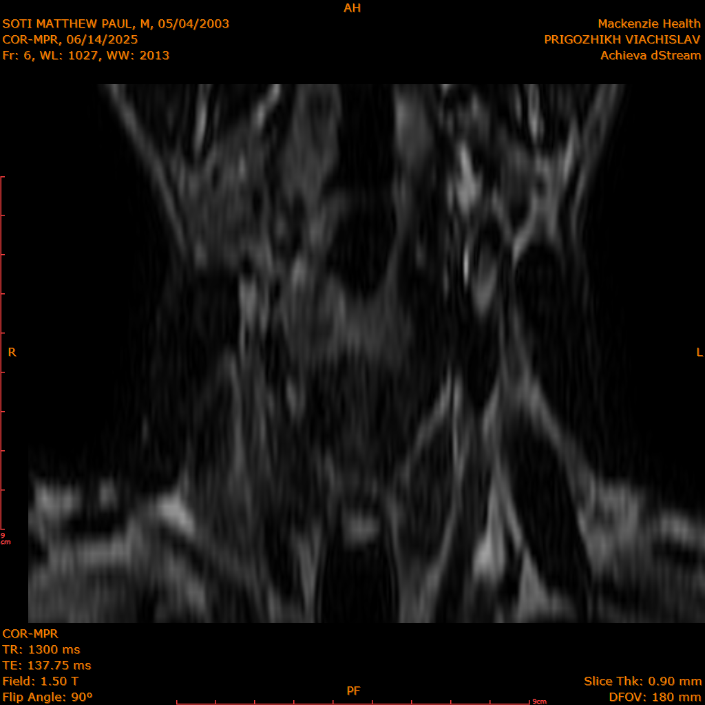 2025-06-14/COR-MPR/0007-.png