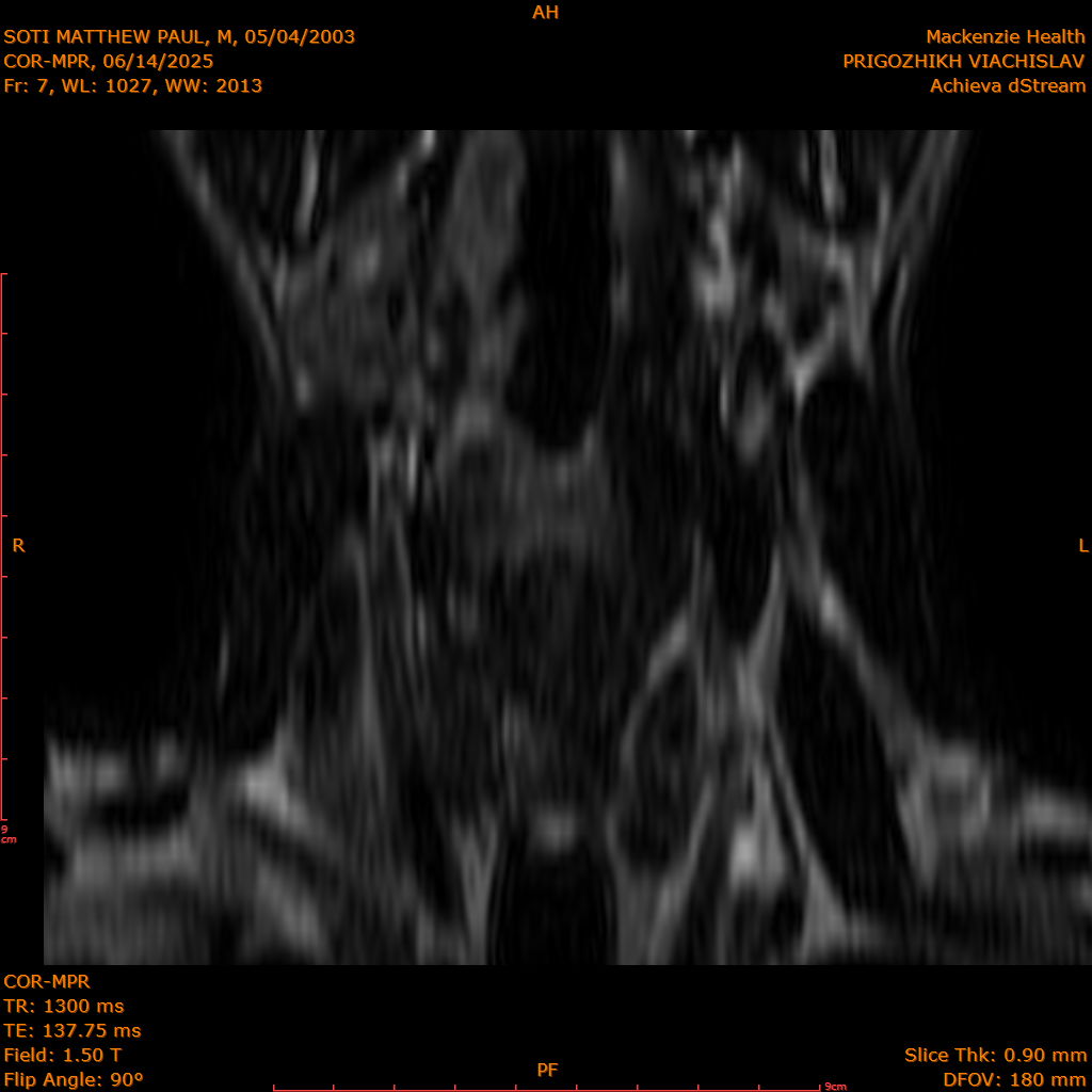 2025-06-14/COR-MPR/0008-.png