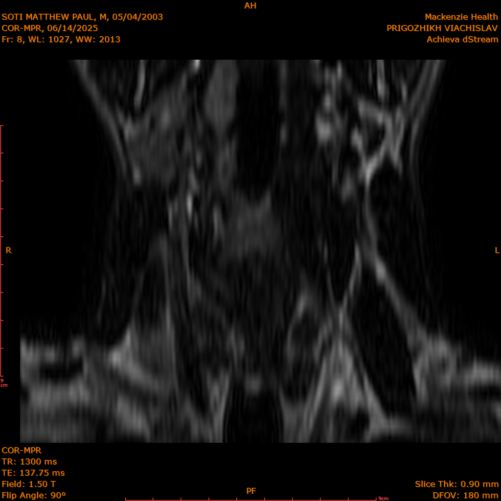 2025-06-14/COR-MPR/0009-.png