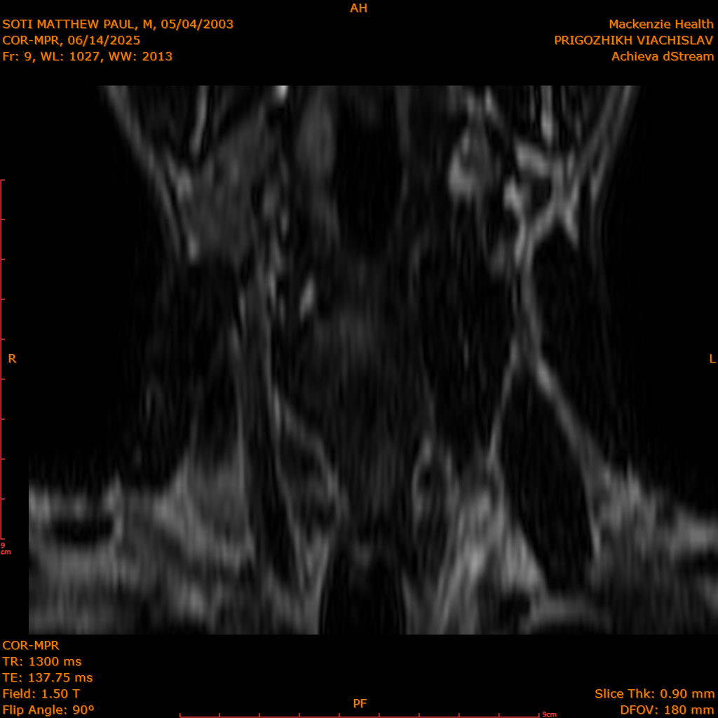 2025-06-14/COR-MPR/0010-.png