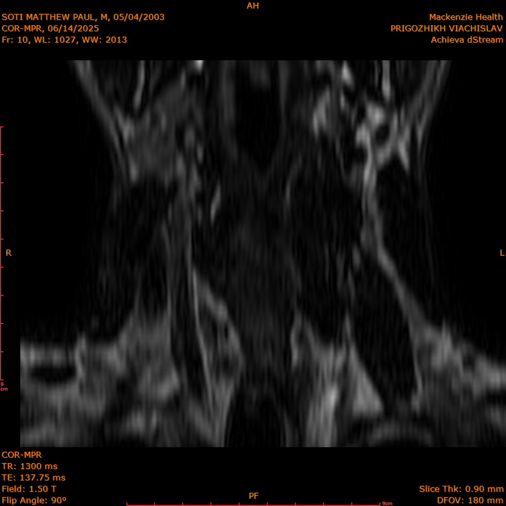 2025-06-14/COR-MPR/0011-.png