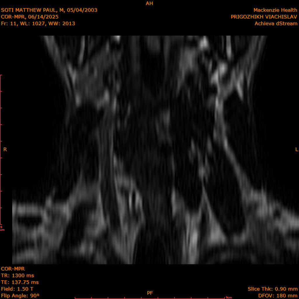 2025-06-14/COR-MPR/0012-.png