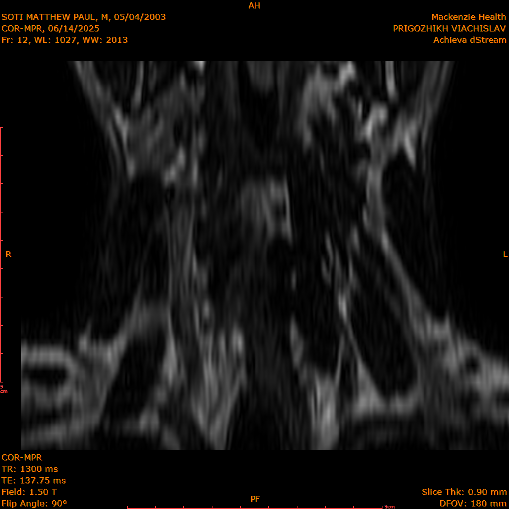 2025-06-14/COR-MPR/0013-.png