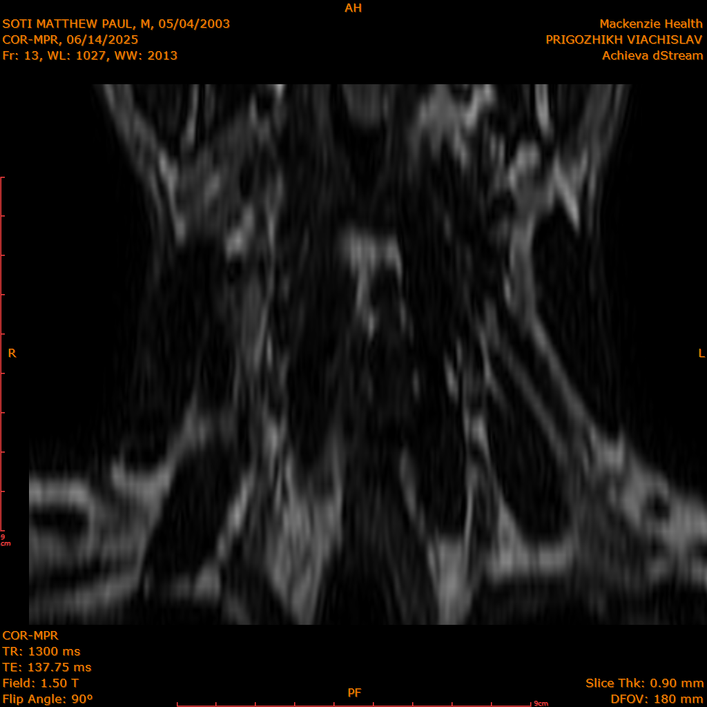 2025-06-14/COR-MPR/0014-.png