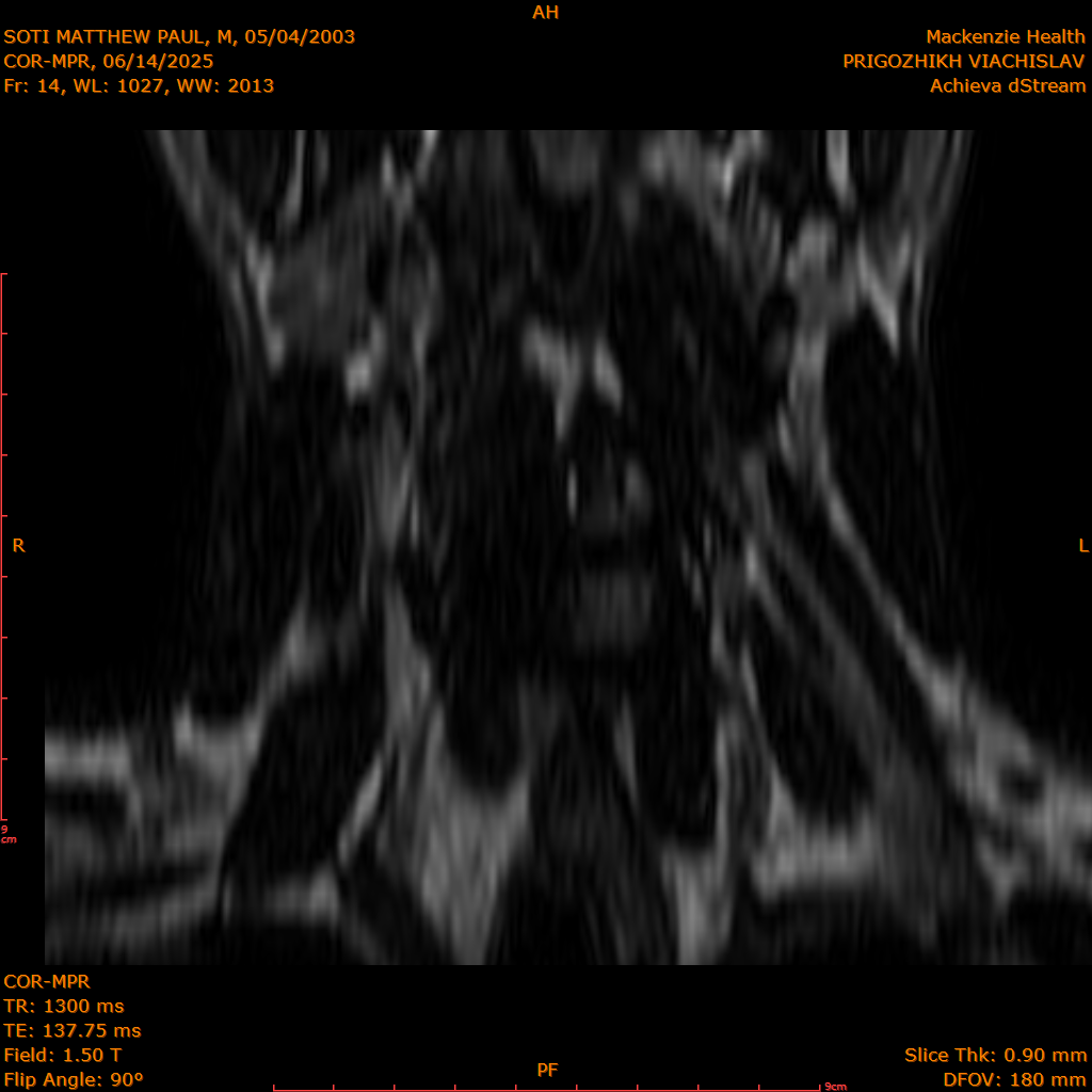 2025-06-14/COR-MPR/0015-IM100.png