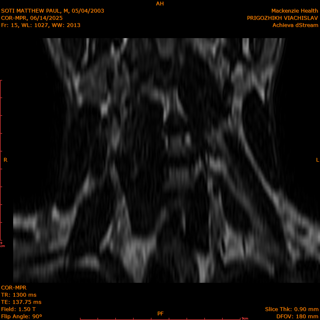 2025-06-14/COR-MPR/0016-IM101.png