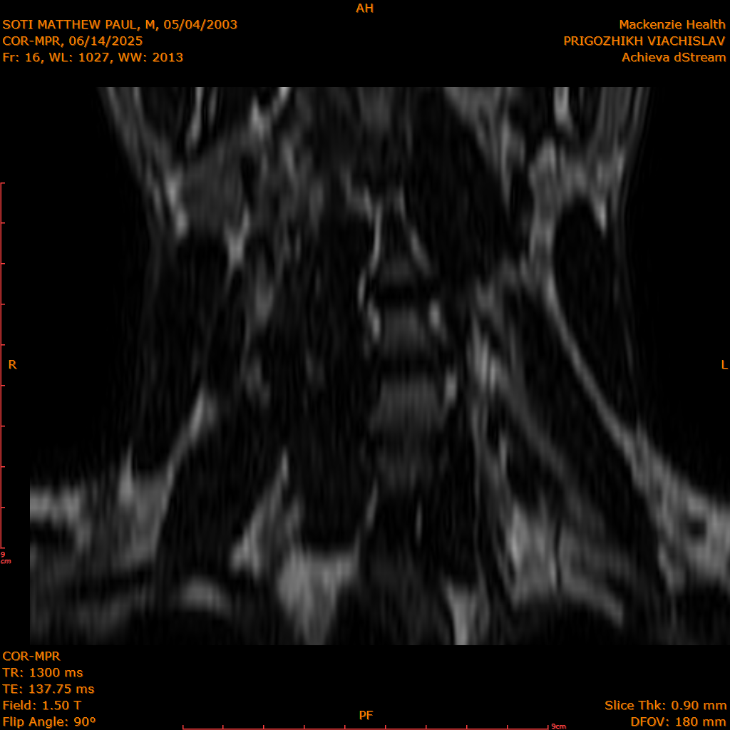 2025-06-14/COR-MPR/0017-IM102.png