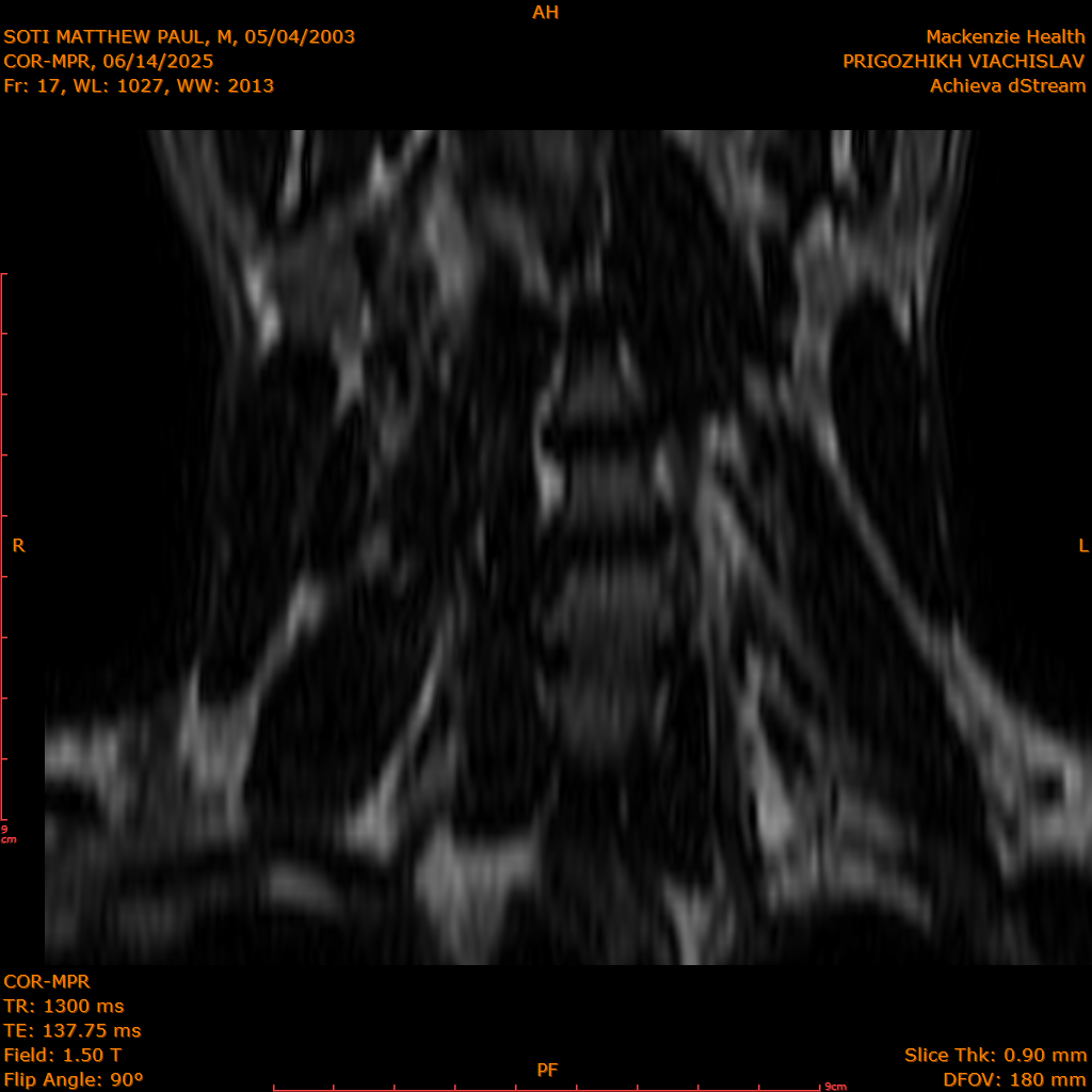 2025-06-14/COR-MPR/0018-IM103.png