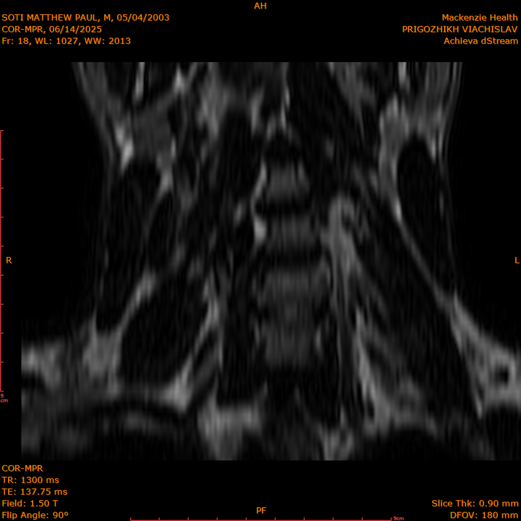 2025-06-14/COR-MPR/0019-IM104.png