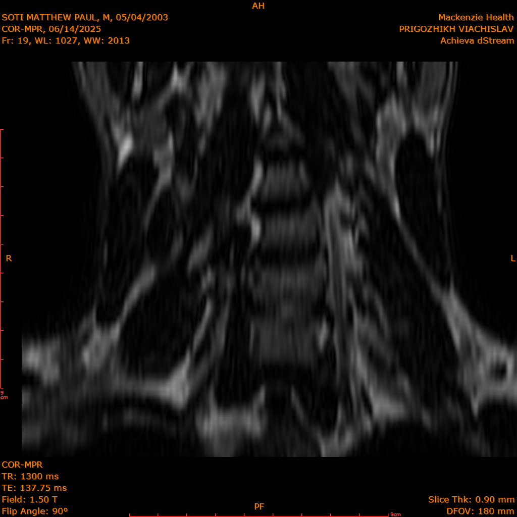 2025-06-14/COR-MPR/0020-IM105.png