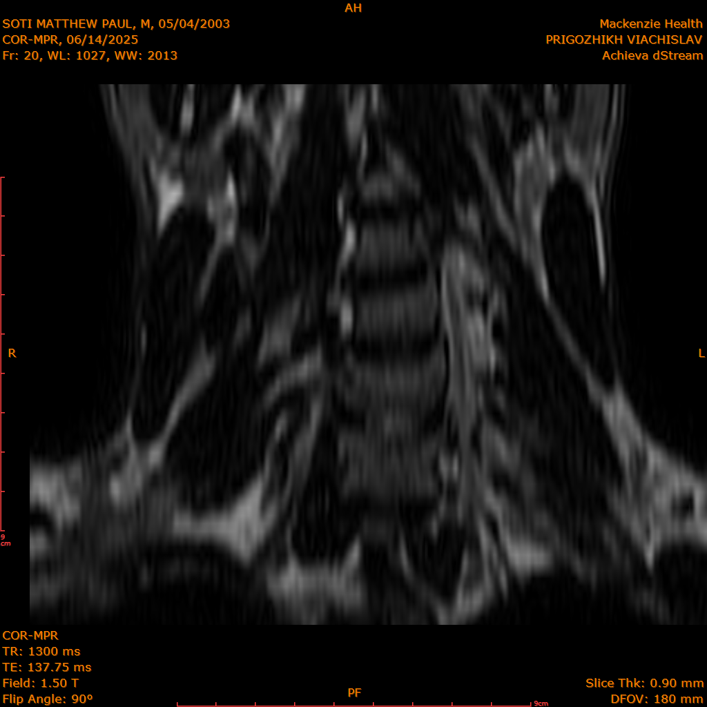 2025-06-14/COR-MPR/0021-IM106.png