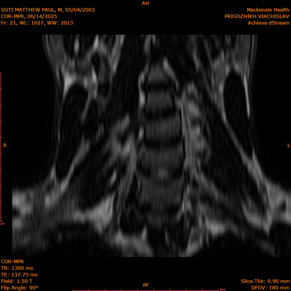 2025-06-14/COR-MPR/0022-IM107.png