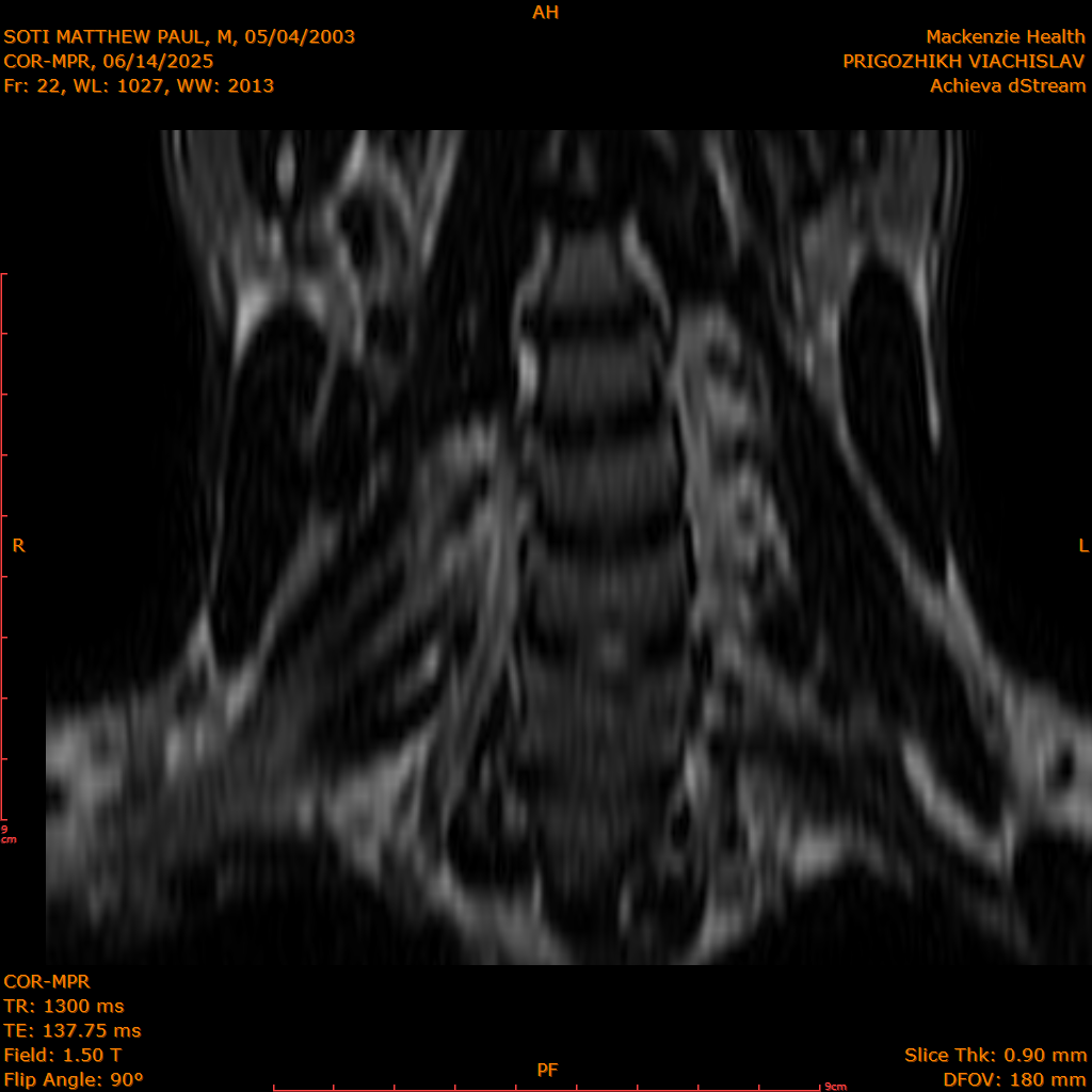 2025-06-14/COR-MPR/0023-IM108.png