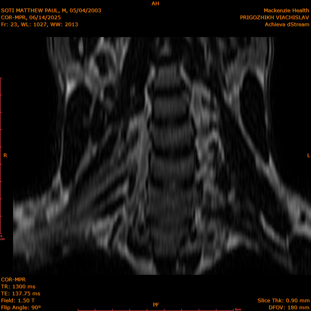2025-06-14/COR-MPR/0024-IM109.png