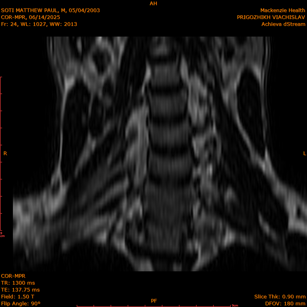 2025-06-14/COR-MPR/0025-IM110.png