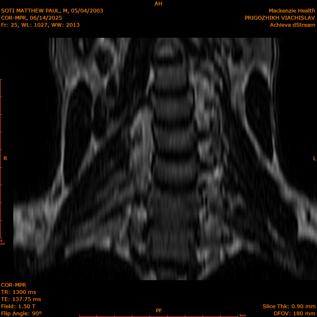2025-06-14/COR-MPR/0026-IM111.png