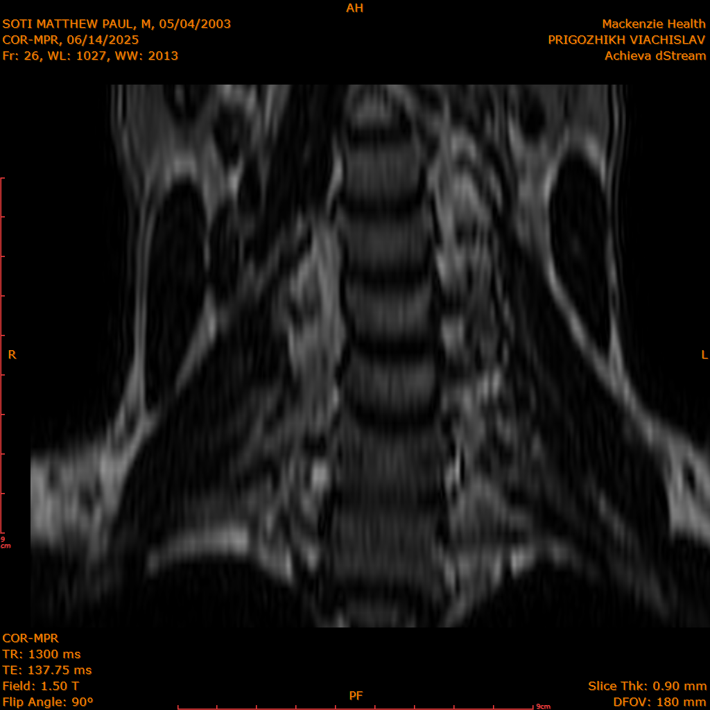 2025-06-14/COR-MPR/0027-IM112.png