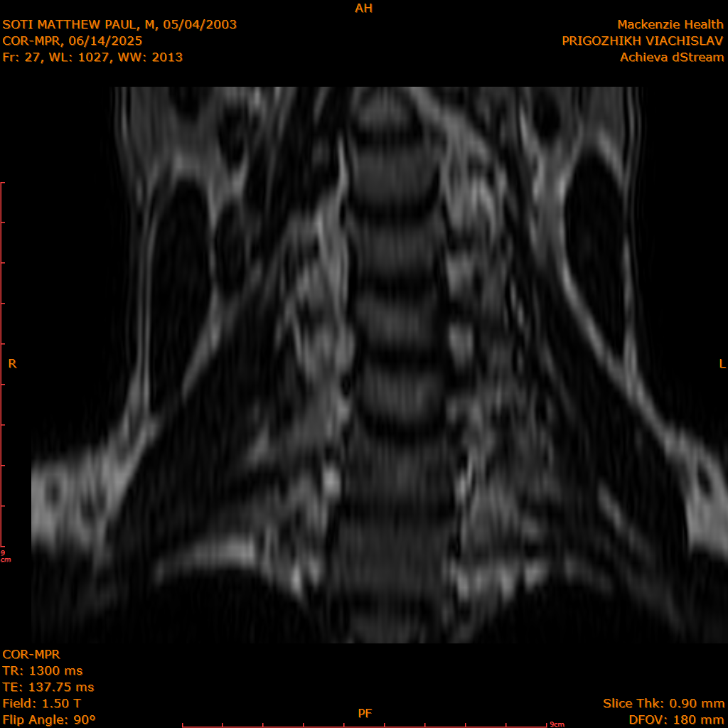 2025-06-14/COR-MPR/0028-IM113.png
