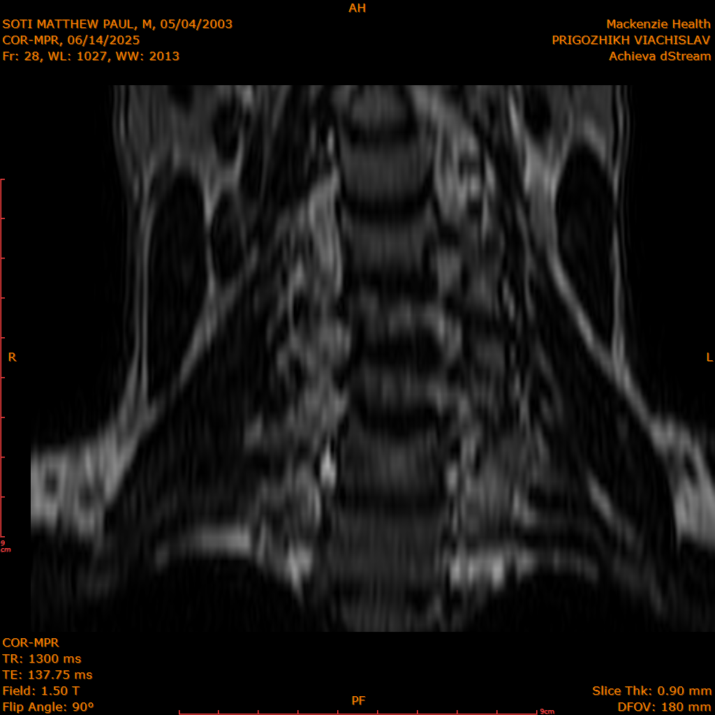 2025-06-14/COR-MPR/0029-IM114.png