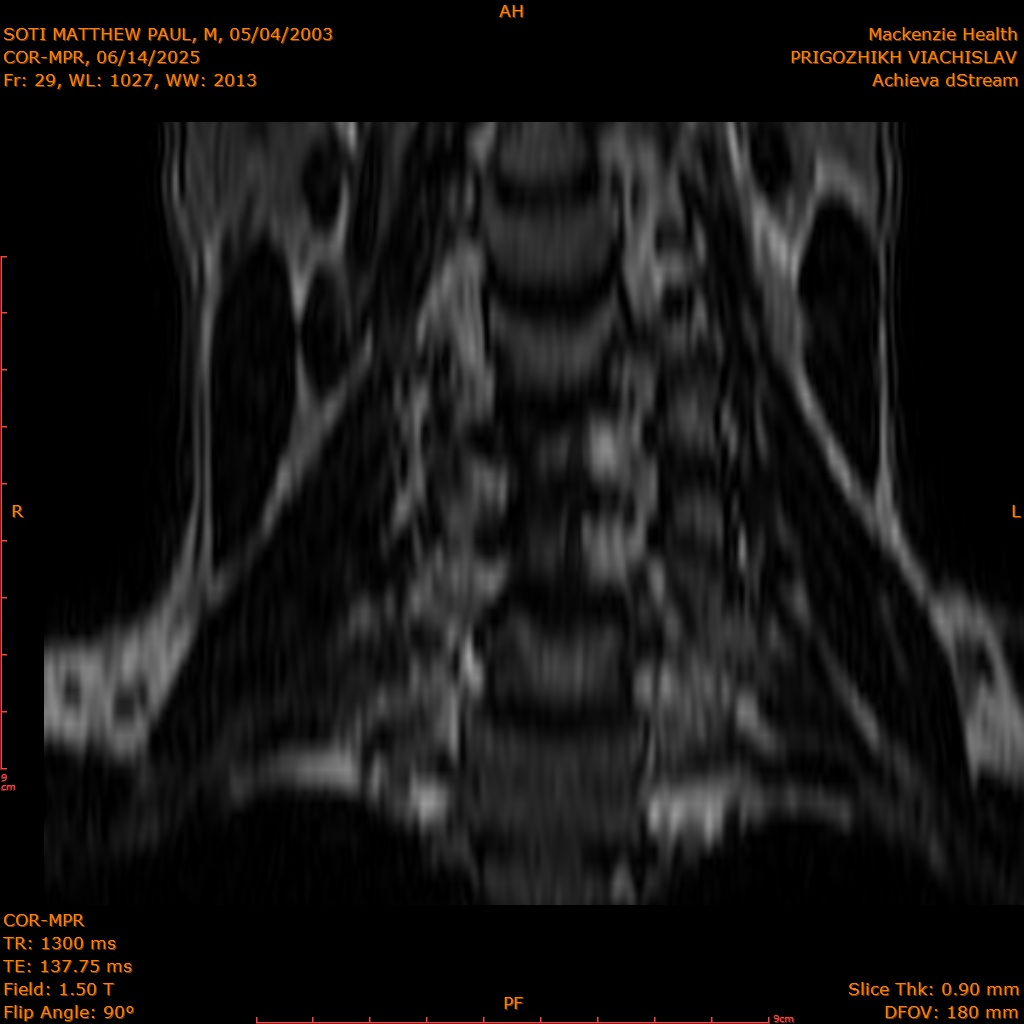 2025-06-14/COR-MPR/0030-IM115.png