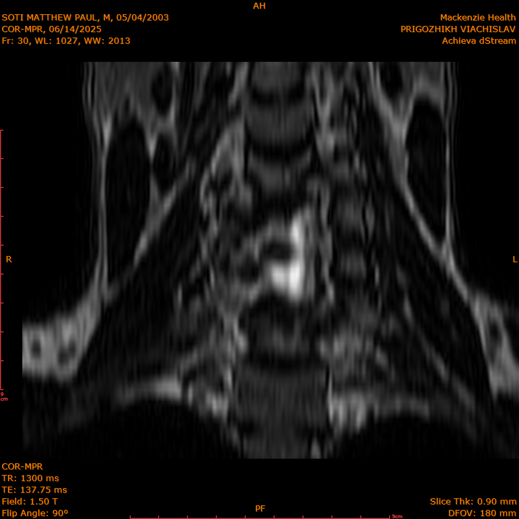 2025-06-14/COR-MPR/0031-IM116.png