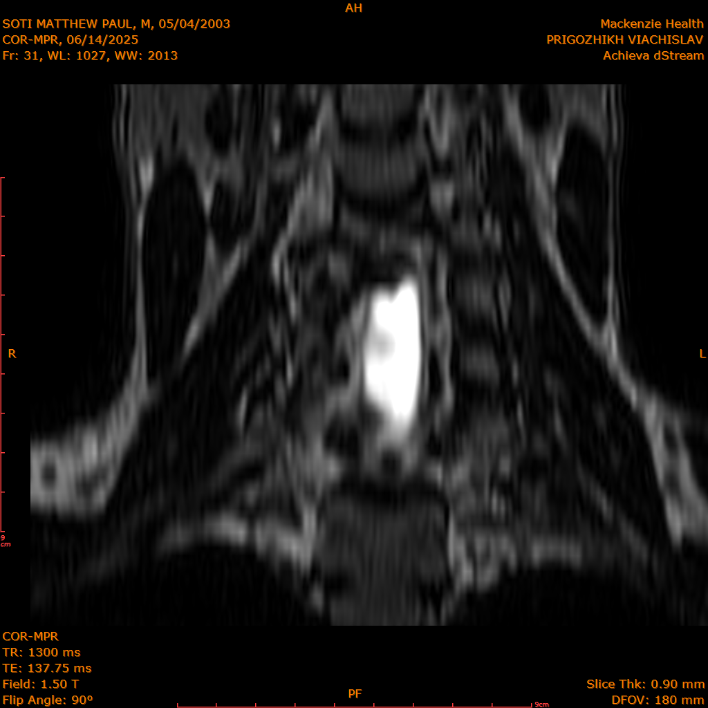 2025-06-14/COR-MPR/0032-IM117.png