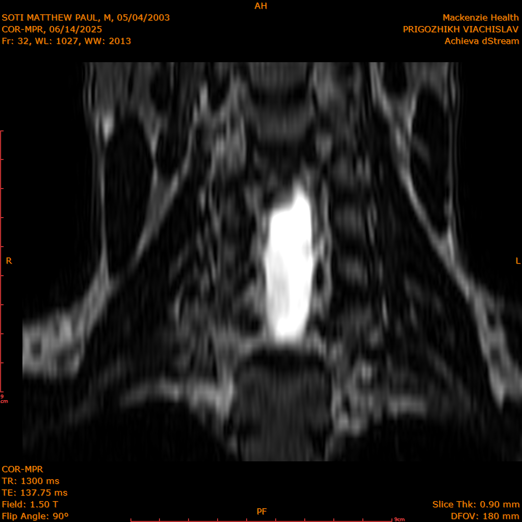 2025-06-14/COR-MPR/0033-IM118.png