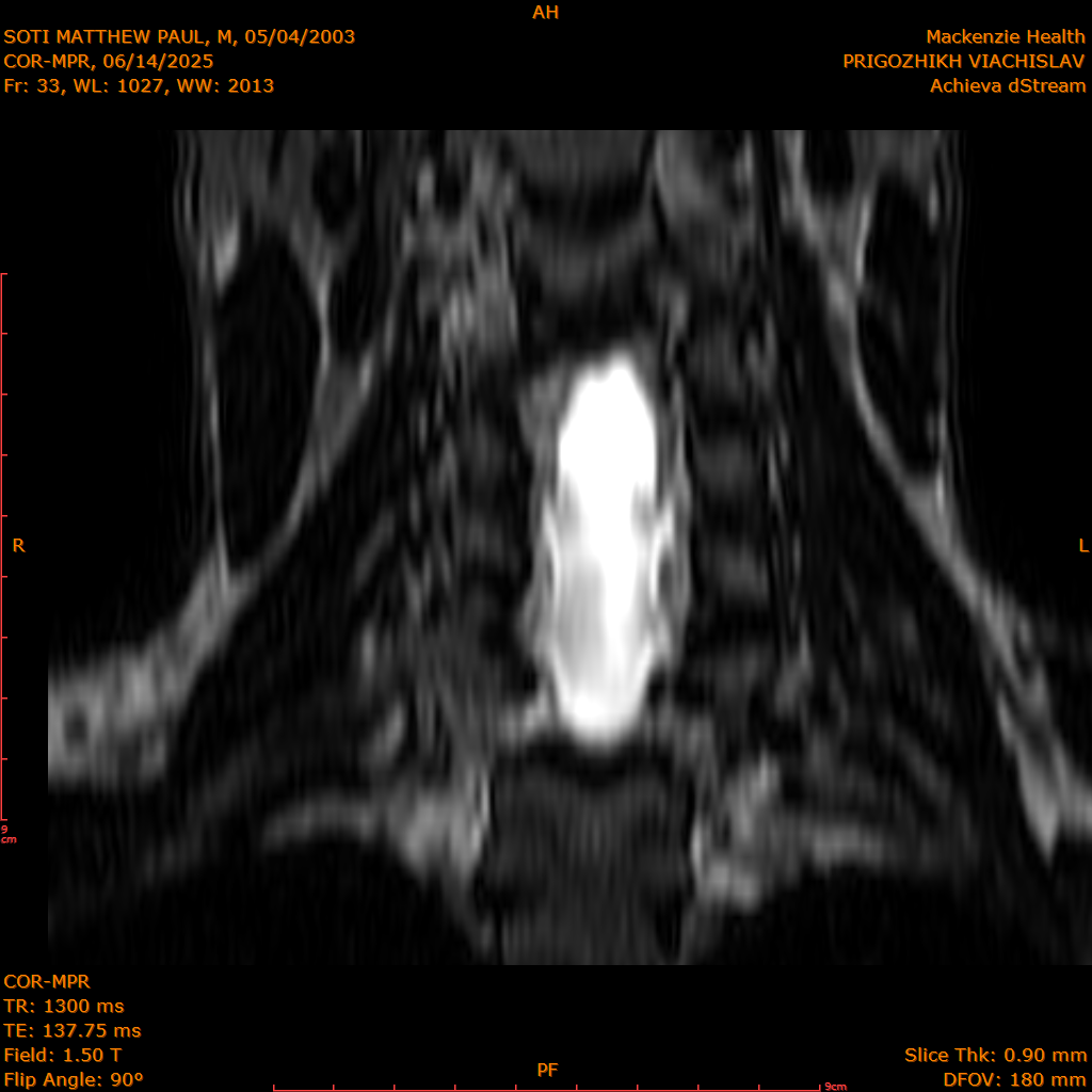 2025-06-14/COR-MPR/0034-IM119.png