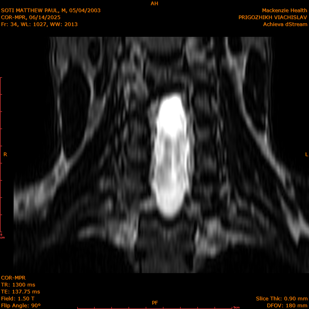 2025-06-14/COR-MPR/0035-IM120.png