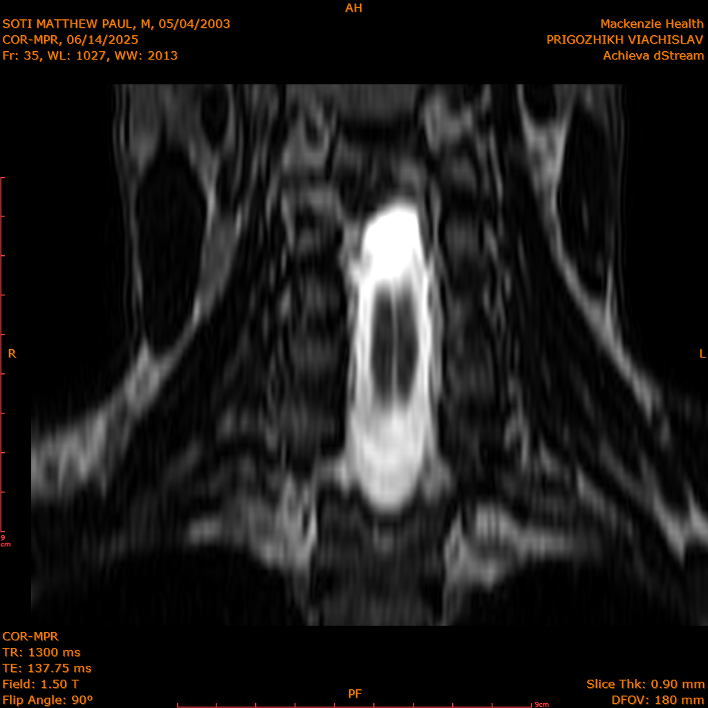 2025-06-14/COR-MPR/0036-IM121.png