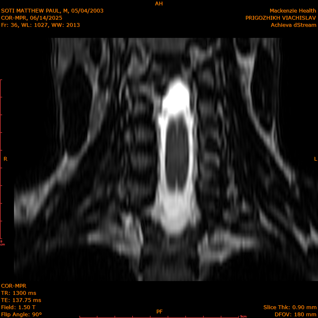2025-06-14/COR-MPR/0037-IM122.png