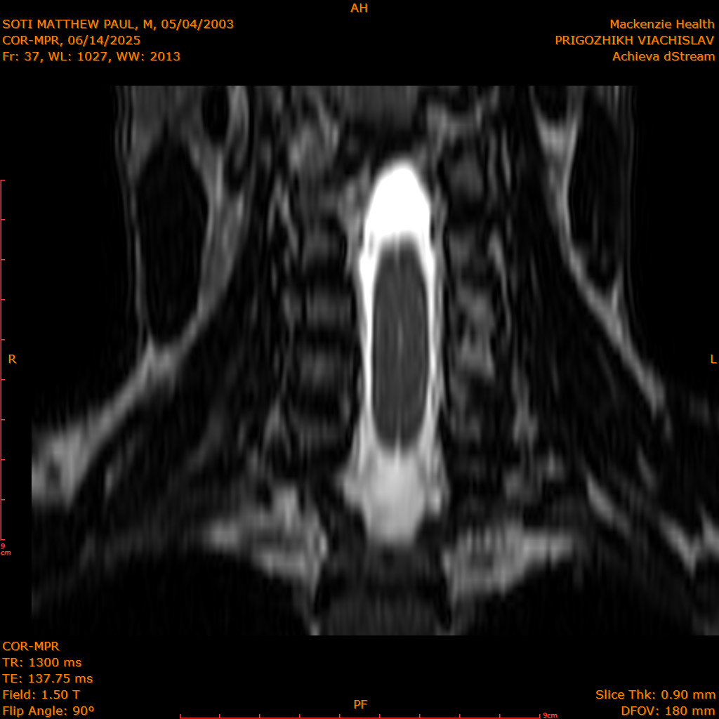 2025-06-14/COR-MPR/0038-IM123.png