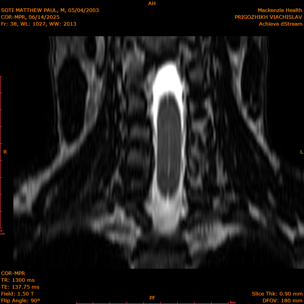 2025-06-14/COR-MPR/0039-IM124.png