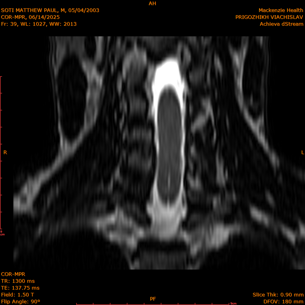2025-06-14/COR-MPR/0040-IM125.png