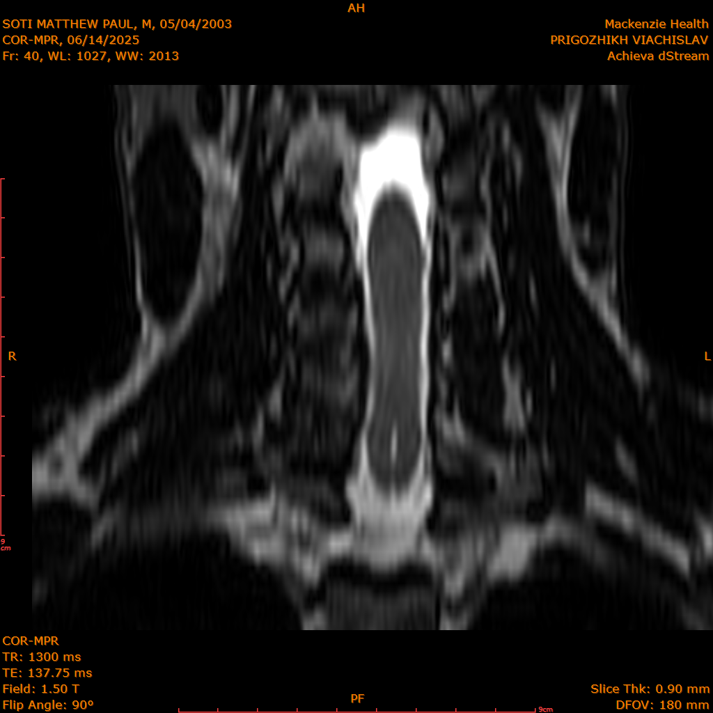 2025-06-14/COR-MPR/0041-IM126.png